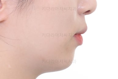 부산연산동부분교정