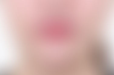 부산개방교합