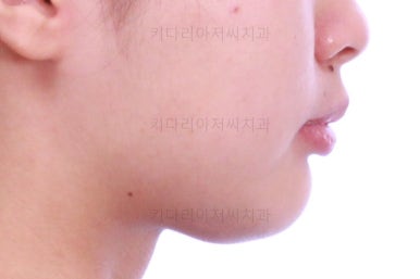 부산치아교정치과