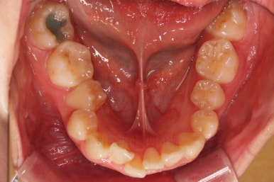 부산무턱교정치과