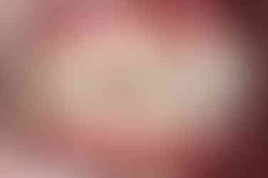 부산치아교정잘하는곳