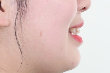 부산치아교정치과