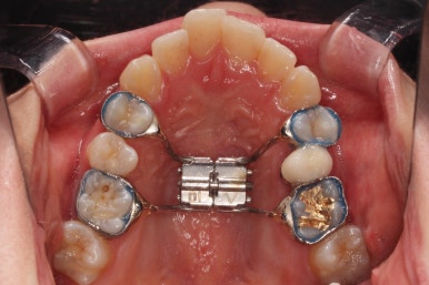 부산비대칭교정