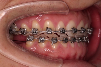 연산동임플란트