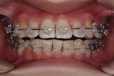 연산동교정치과