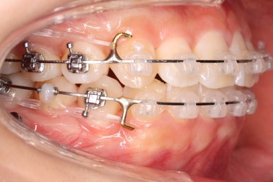 연산동교정치과