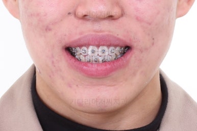 부산교정과전문의