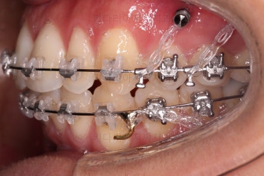 부산연제구교정