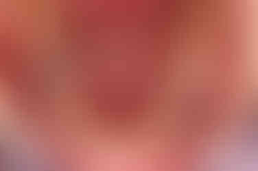 부산비발치교정