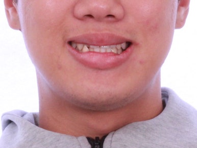 부산교정치과추천