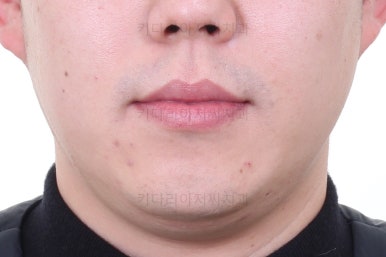 부산인비절라인