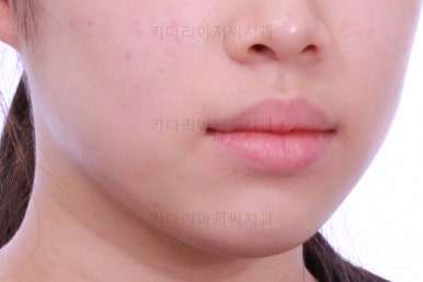 부산치과