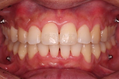 부산교정치과추천