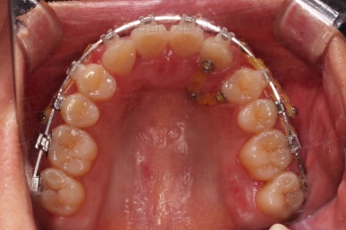 연산동교정치과