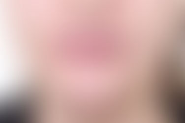 부산개방교합