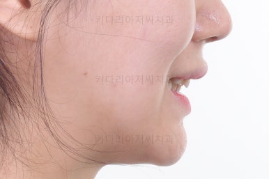 연산동교정치과