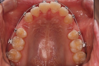사직동교정치과