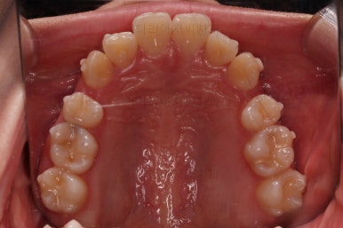 부산교정전문의