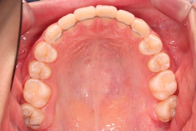 부산청소년교정치과