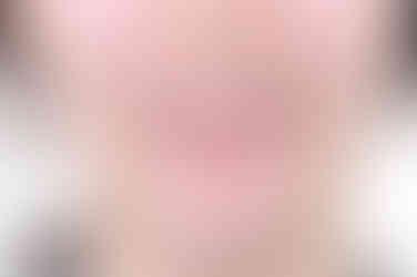 부산부분치아교정