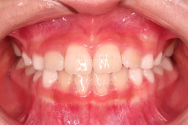 부산어린이교정