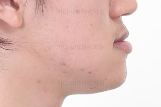 부산군인교정