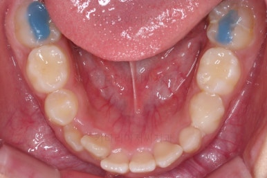 부산어린이교정