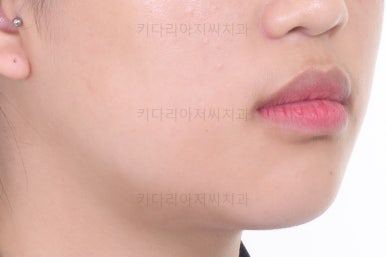 사직동교정치과