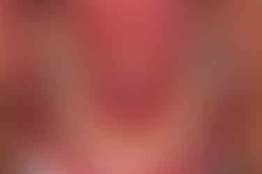 부산연산역치아교정