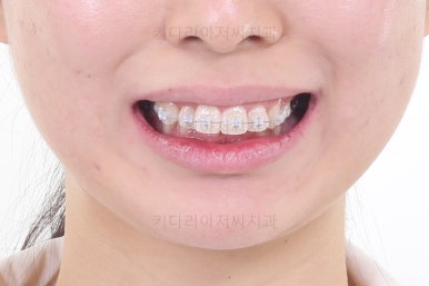 부산무턱교정치과