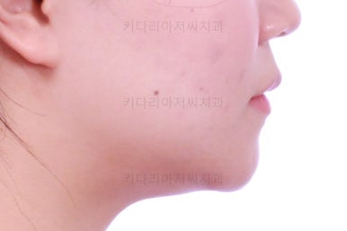 부산교정전문의