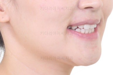 연산동교정치과