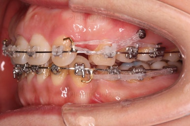 연산동교정치과