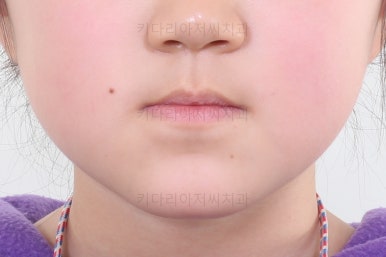 부산초등학생교정