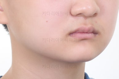 부산청소년교정치과