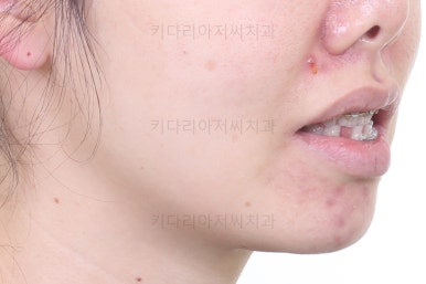 부산재교정치과