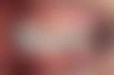 부산치아교정잘하는곳