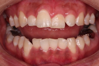 부산안면비대칭