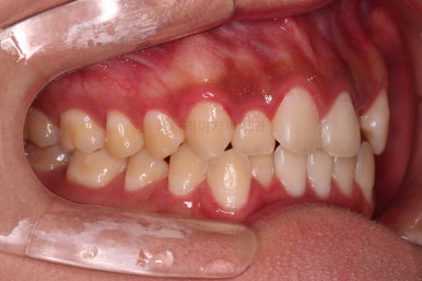 부산치아교정치과