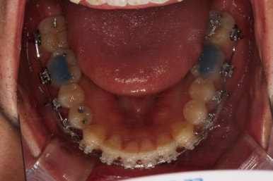 부산연제구교정
