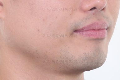 부산교정치과추천