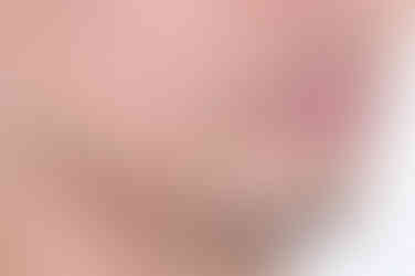 부산교정치과추천