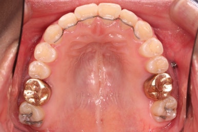 부산안면비대칭