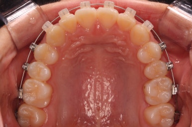 부산치아교정잘하는곳