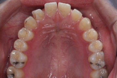 부산치아교정치과