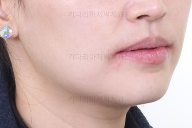 연산동교정치과