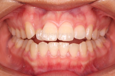 사직동교정치과