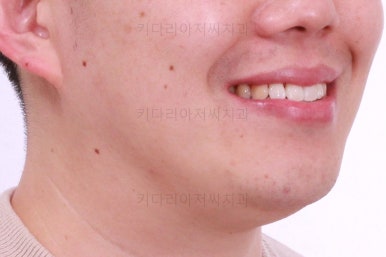 부산인비절라인