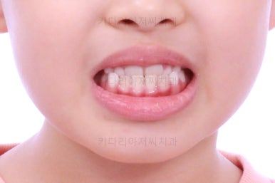 부산어린이교정