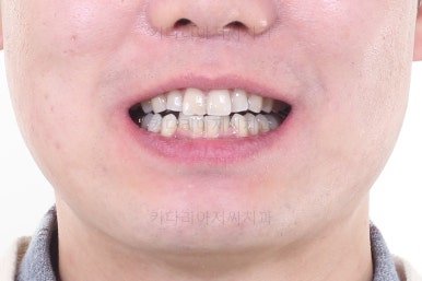 부산교정치과